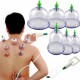Set Ventosas Chinas Cupping (Entrega Inmediata)