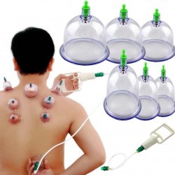 Set Ventosas Chinas Cupping (Entrega Inmediata)