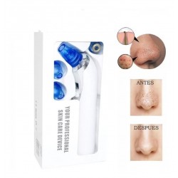 Extractor De Espinillas Y Puntos Negros Facial Digital (Entrega Inmediata)