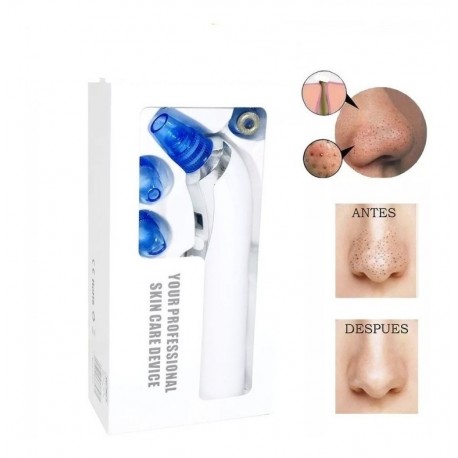 Extractor De Espinillas Y Puntos Negros Facial Digital (Entrega Inmediata)