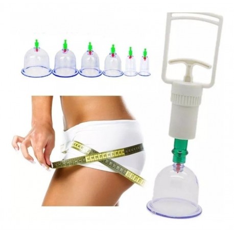 Set Masajeador Ventosas Chinas Vacumterapia, Cupping (Entrega Inmediata)