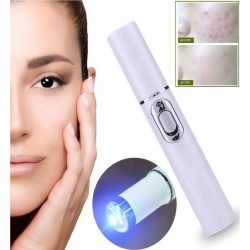 Pluma Láser Portátil Anti Acne