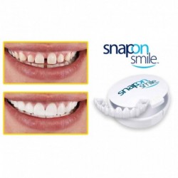Carillas Snap On Smile